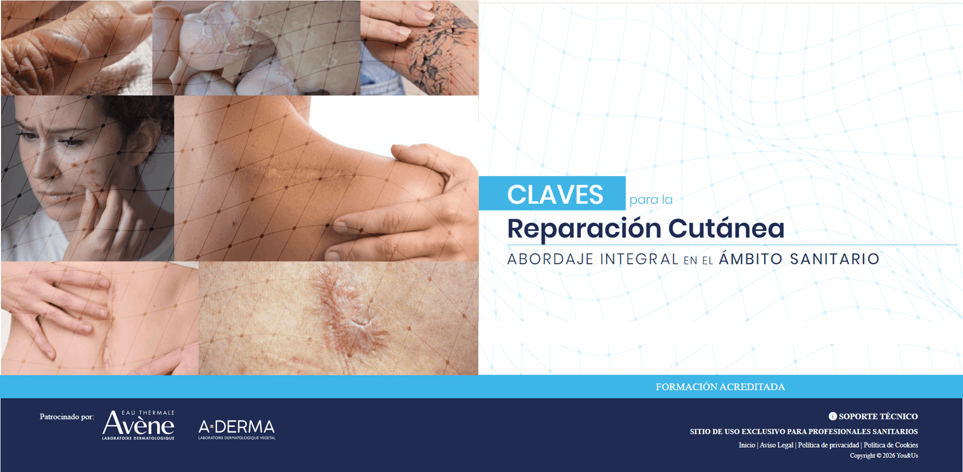 CURSO_Acreditado_Claves_para_la_Reparaci_n_Cut_nea.png