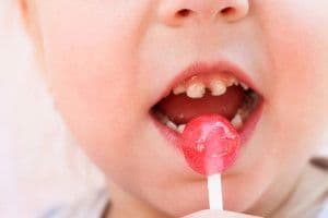 caries.shutterstock_680755111.jpg