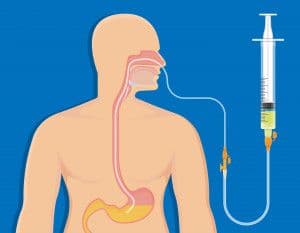 nutricion_enteral.shutterstock_1058948873.jpg
