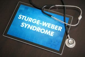 sturge_weber.jpg