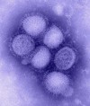 Virus de la gripe H1N1