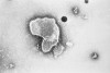 Virus respiratorio sincitial al microscopio electrónico